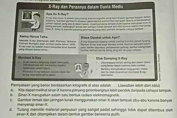 X -Ray dan Perannya dalam Dunia Medis Apa itu X-Ray? X -ray atau sinar X adalah gelombang elektromagnetik yang mencitrakan gambar bagian dalam tubuhmu.