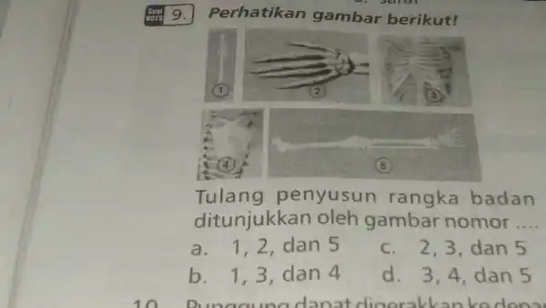 Perhatikan gambar berikut! Tulang penyusun rangka badan ditunjukkan oleh gambar nomor.... a. 1,2 , dan 5 c. 2,3, dan 5 b. 1,3 , dan