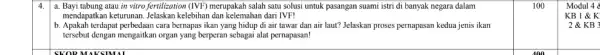 4. a. Bayi tabung atau in vitro fertilization (IVF) merupakah salah satu solusi untuk pasangan suami istri di banyak negara dalam mendapatkan keturunan. Jelaskan