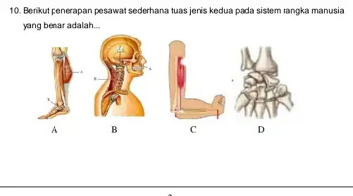 10. Berikut penerapan pesawat sederhana tuas jenis kedua pada sistem langka manusia yang benar adalah. __ A B C D