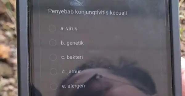 Penyebab konjungtivitis kecuali a. virus b. genetik c. bakteri d. jamur e. alergen