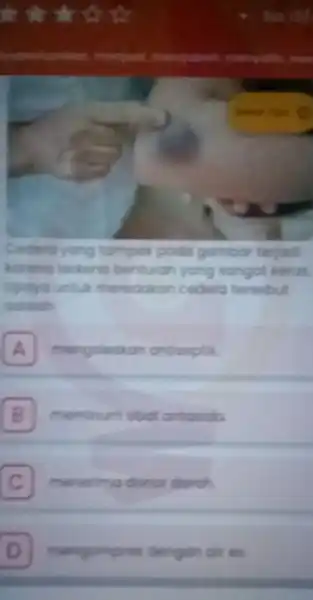 Codero yong tampak podo gambar teriad benturan yang sangat keras Updya untul meredokon codero tersebut adaloh A mengoleskon antiseptik A B meminum obat antasida